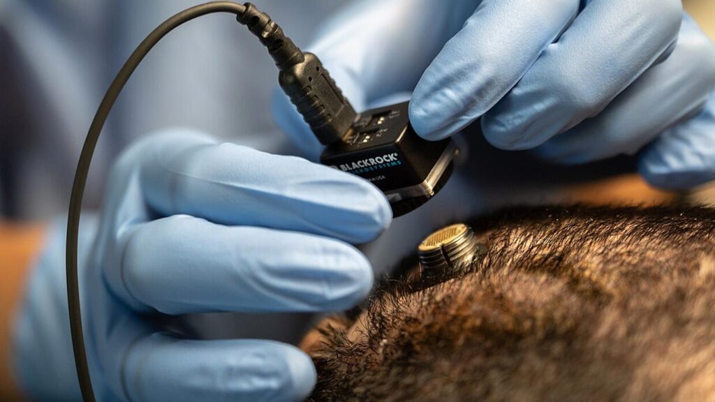 OpenAI and Merge Labs: A Bold Leap Toward Brain-Computer Interfaces